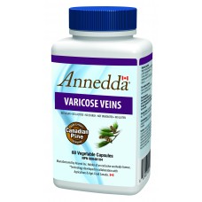 Varicose veins